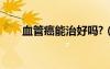 血管癌能治好吗?（血管癌能治好吗）