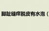 脚趾缝痒脱皮有水泡（脚趾缝发痒脱皮水泡）