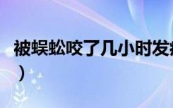 被蜈蚣咬了几小时发病（被蜈蚣咬了多久发作）