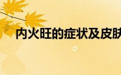 内火旺的症状及皮肤痒（内火旺的症状）