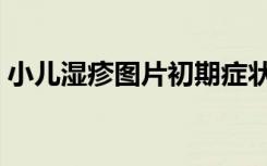小儿湿疹图片初期症状图片（小儿湿疹图片）