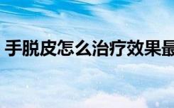 手脱皮怎么治疗效果最好（手脱皮怎么治疗）