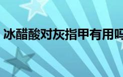 冰醋酸对灰指甲有用吗（醋精能治灰指甲吗）