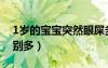 1岁的宝宝突然眼屎多（1岁宝宝突然眼屎特别多）